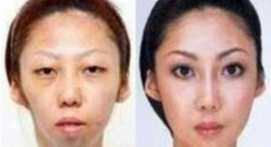 La ex señora Feng, antes y después de sus operaciones de estética. (ideasynoticias.com)