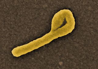 El virus del Ébola, en una imagen coloreada de microscopía electrónica. Imagen de NIAID / Wikipedia.