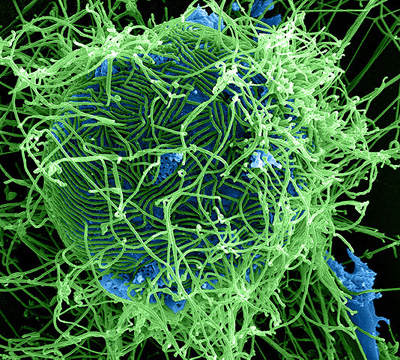 Partículas del virus del Ébola (en verde) sobre una célula infectada (azul). Imagen de NIAID / Wikipedia.